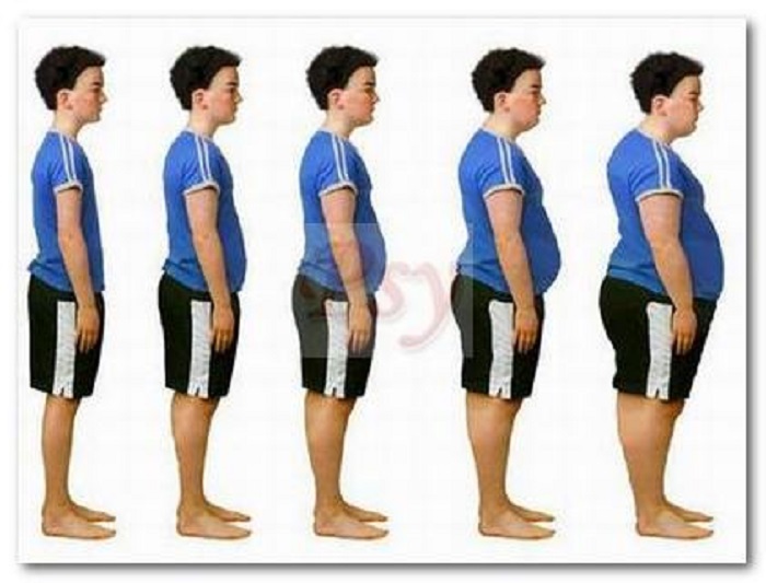 obesity